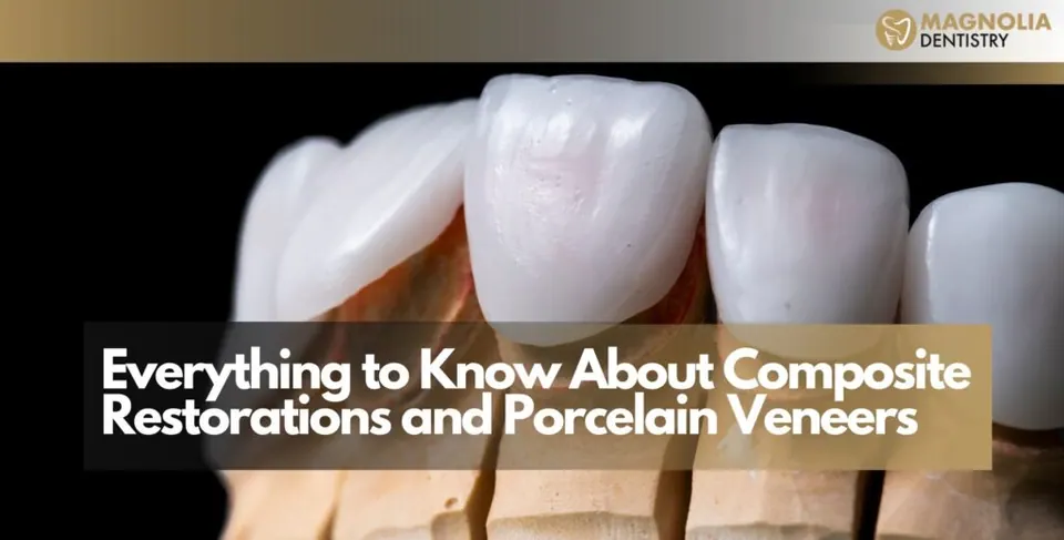 Everything to Know About Composite Restorations and Porcelain Veneers