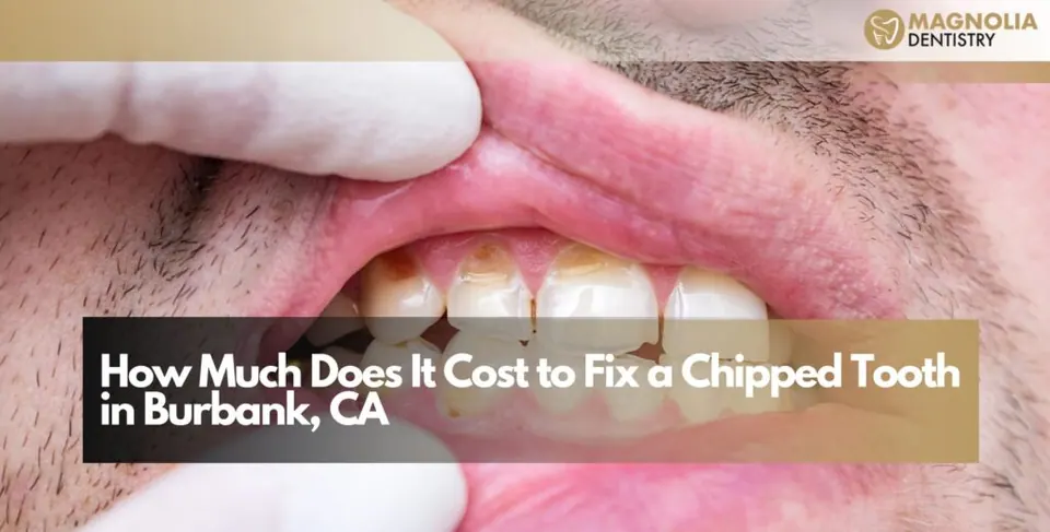 How Much Does It Cost to Fix a Chipped Tooth in Burbank, CA