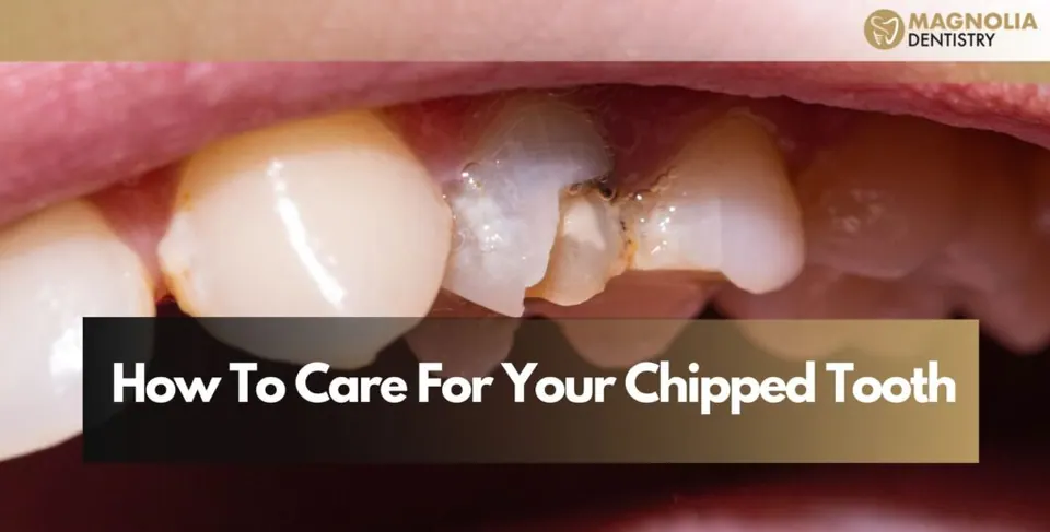 How To Care For Your Chipped Tooth