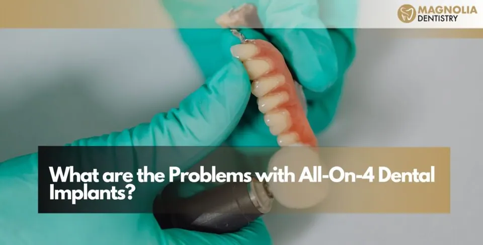 What are the Problems with All-On-4 Dental Implants