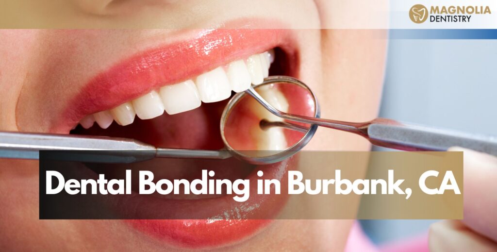 Dental Bonding in Burbank, CA