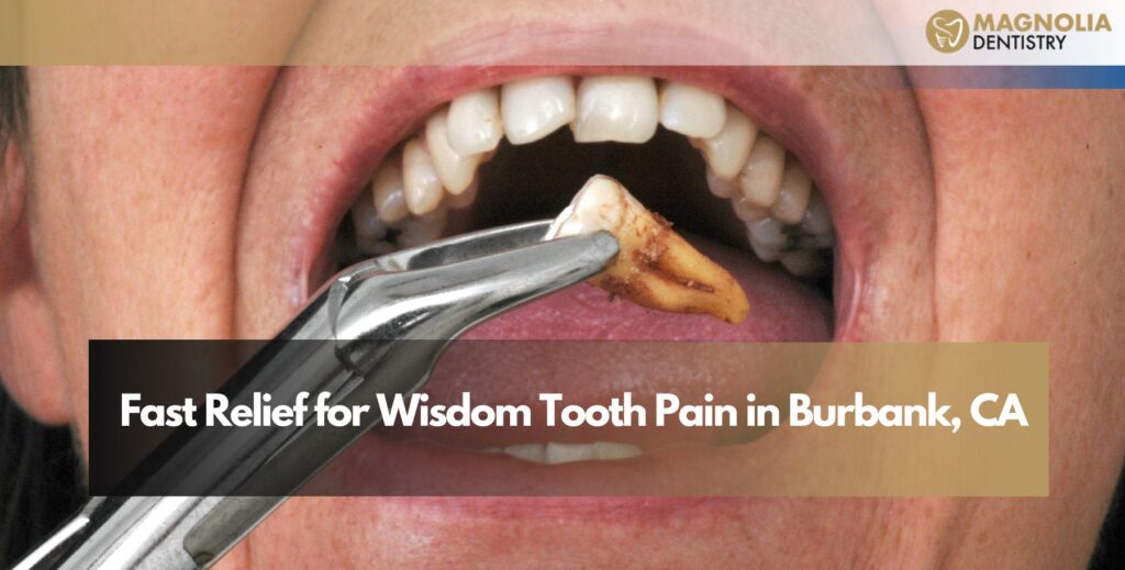 Fast Relief for Wisdom Tooth Pain in Burbank, CA