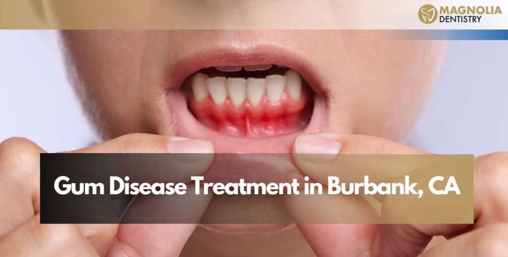 Gum Disease Treatment in Burbank, CA