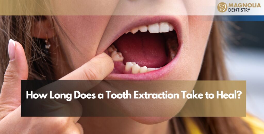 How Long Does a Tooth Extraction Take to Heal?