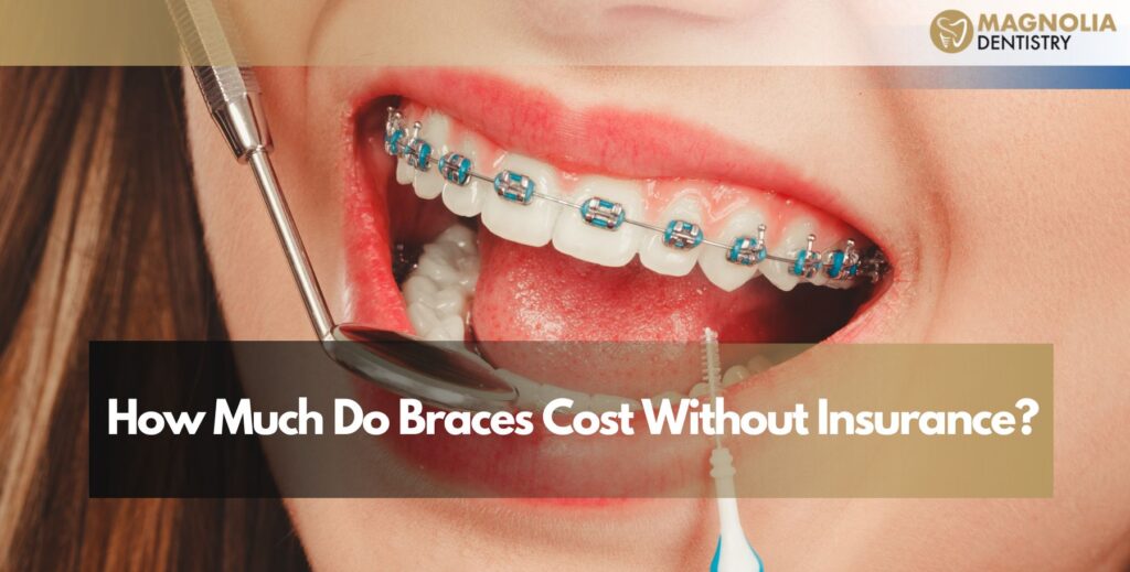 Braces Cost Without Insurance
