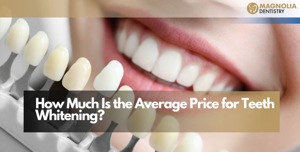 How Much Is the Average Price for Teeth Whitening?