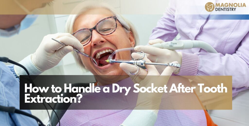 How to Handle a Dry Socket After Tooth Extraction?
