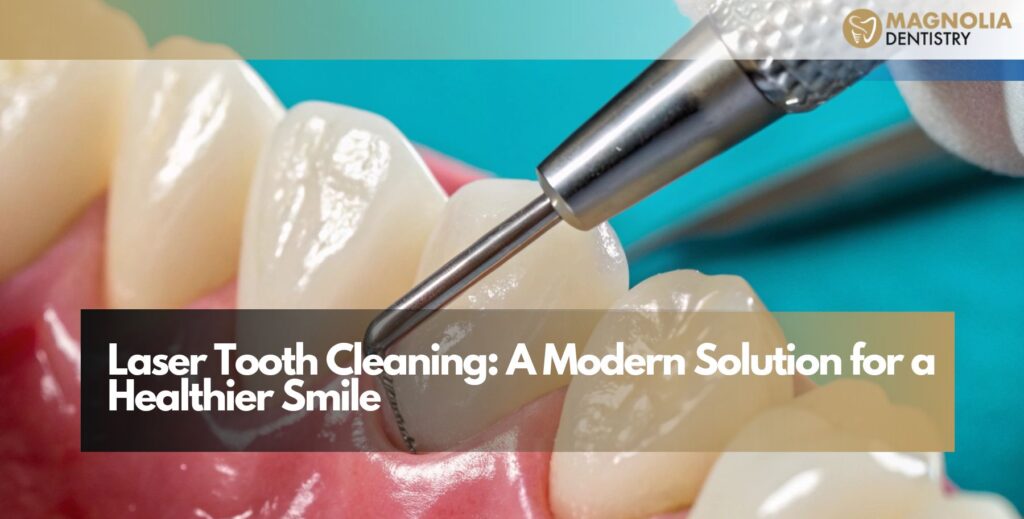 Laser Tooth Cleaning