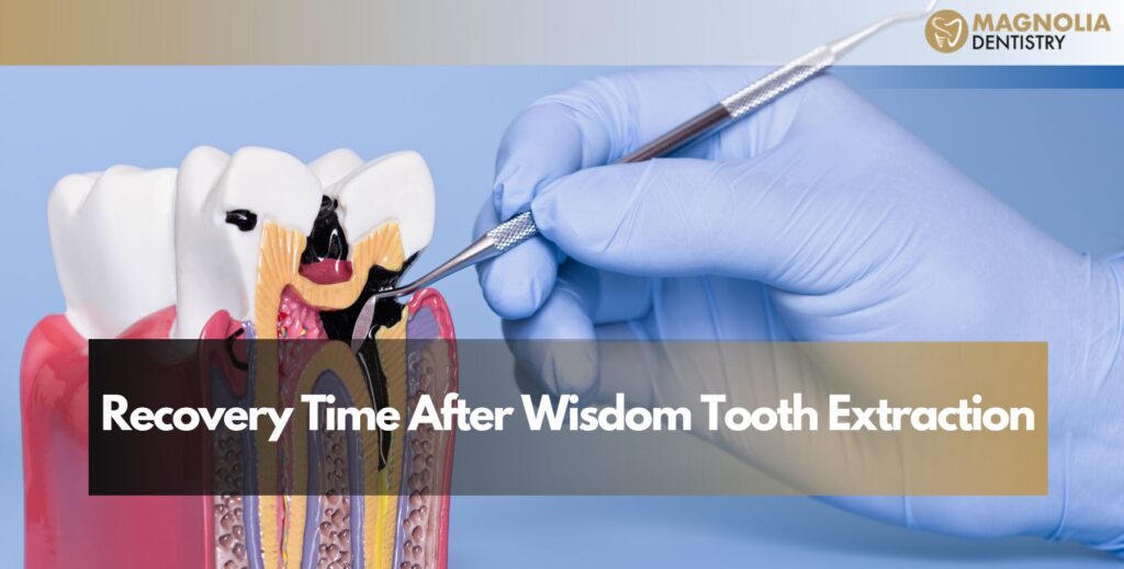 Recovery Time After Wisdom Tooth Extraction