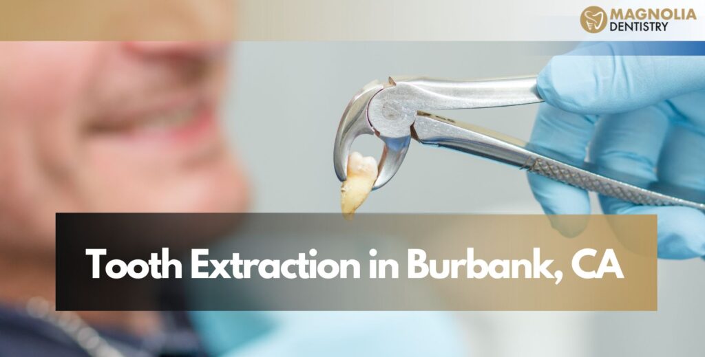 Tooth Extraction in Burbank, CA