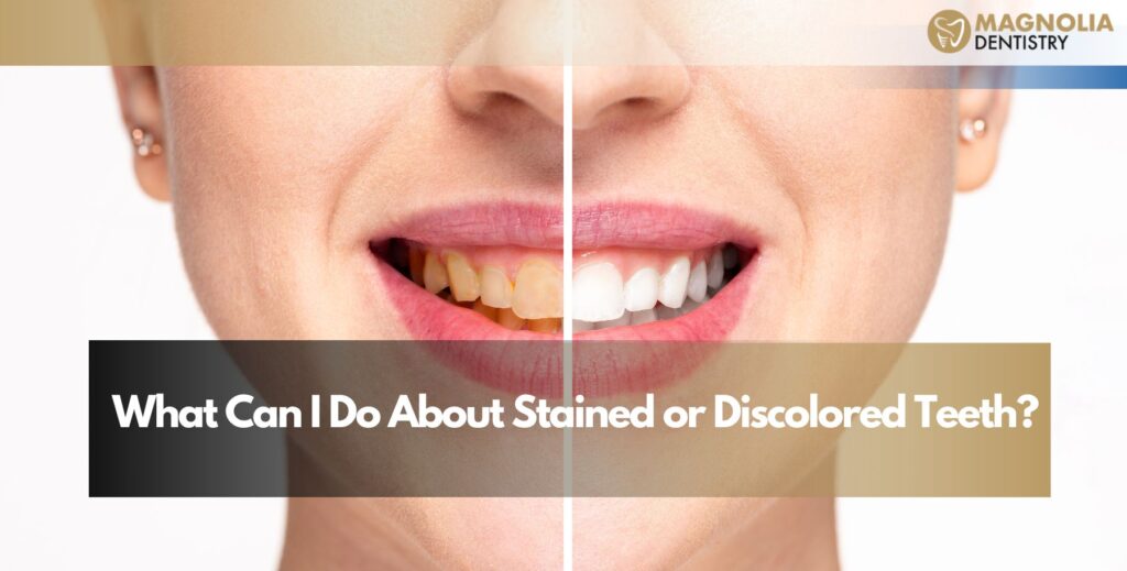 What Can I Do About Stained or Discolored Teeth?