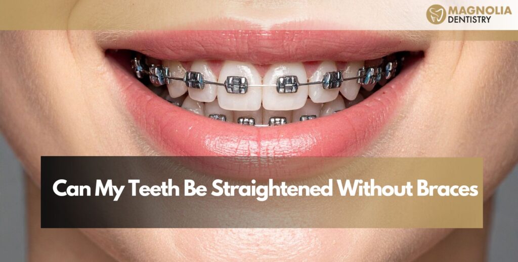 Can My Teeth Be Straightened Without Braces