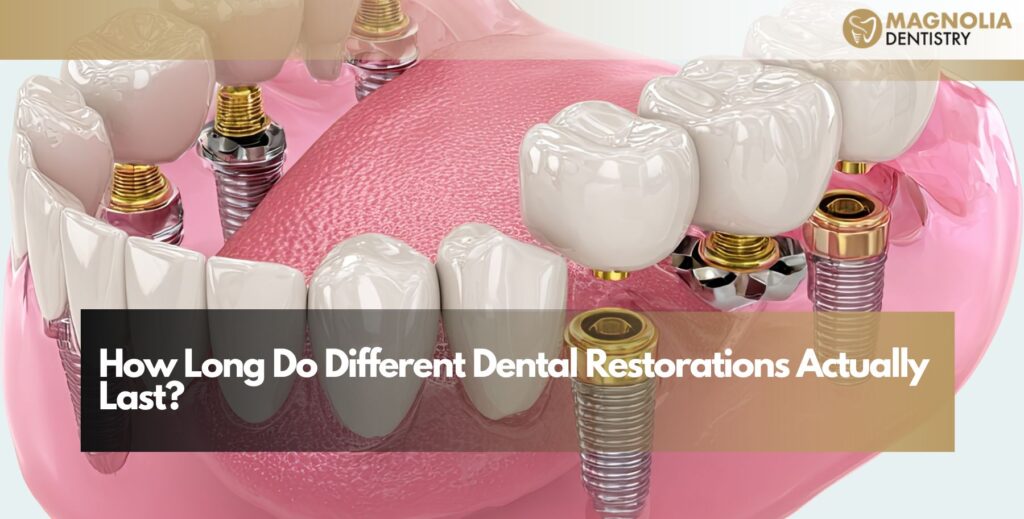How Long Do Different Dental Restorations Actually Last