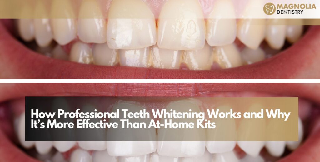 How Professional Teeth Whitening Works and Why It’s More Effective Than At-Home Kits