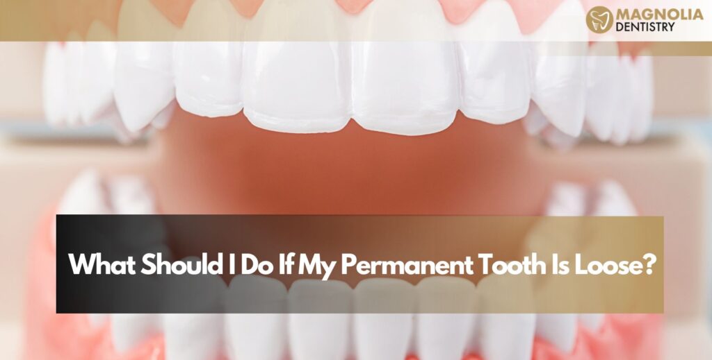 What Should I Do If My Permanent Tooth Is Loose