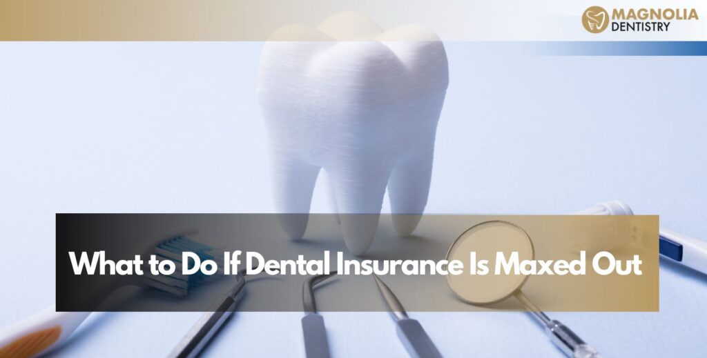 What to Do If Dental Insurance Is Maxed Out