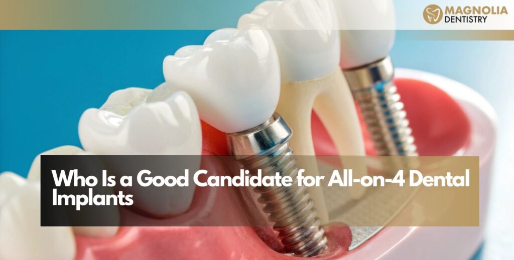 Who Is a Good Candidate for All-on-4 Dental Implants