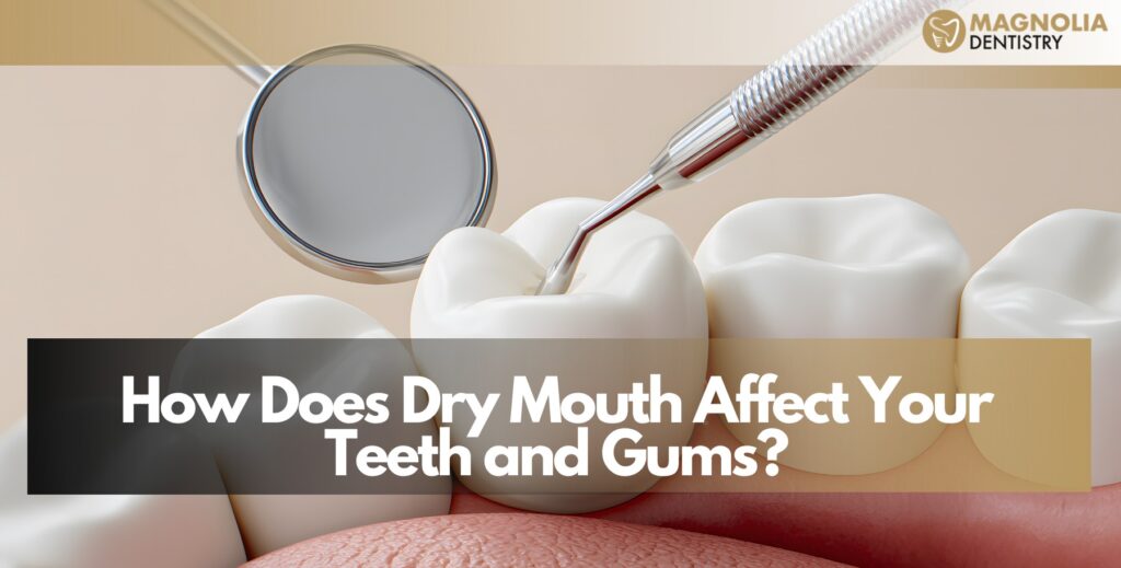 Dry Mouth and Oral Health in Burbank, CA